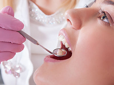 A dental professional performing a teeth cleaning procedure on a patient in a clinical setting.